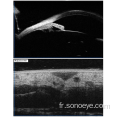 Microscope à ultrasons biomicroscopie pour les yeux